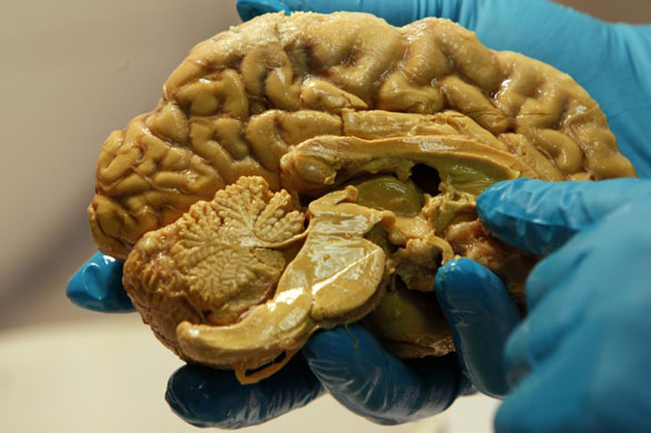 10 мита за човешкия мозък