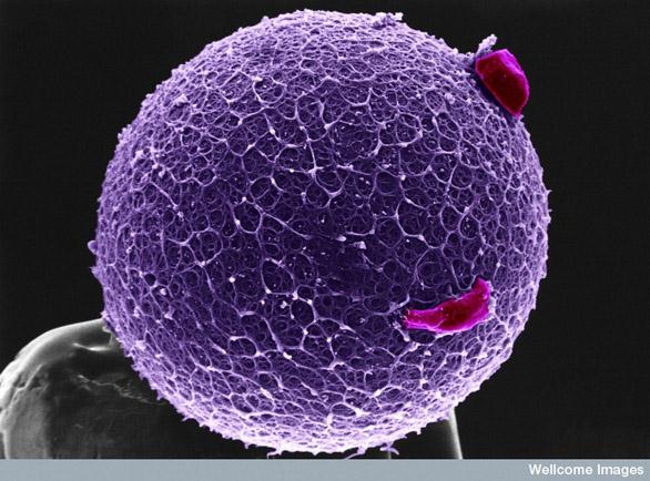 B0002099 Human egg with coronal cells - purple