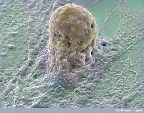 B0006219 Human embryonic stem cell