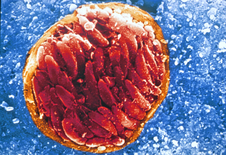 Около 50% от глобалното население е било заразено с паразита toxoplasma gondii