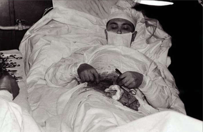 Леонид Рогозов извършва апендектомия върху себе си