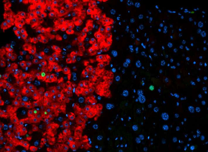 Учени откриха начин да превръщат кожни клетки в чернодробни